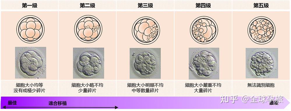 第三代试管婴儿技术解析：从基因筛查到精准移植实现优生优育-广州好孕试管